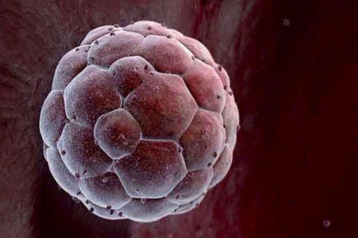 Diario Médico (@diariomedico) on Twitter photo #Hematología | ➡️La producción, cada vez más fiable, de #células madre sanguíneas allana el camino hacia la consolidación de la #medicina regenerativa. ➡️Nuevo avance del <a href="/CarrerasIJC/">Josep Carreras Leukaemia Research Institute (IJC)</a>
diariomedico.com/medicina/hemat… #Hematología | ➡️La producción, cada vez más fiable, de #células madre sanguíneas allana el camino hacia la consolidación de la #medicina regenerativa. ➡️Nuevo avance del <a href="/CarrerasIJC/">Josep Carreras Leukaemia Research Institute (IJC)</a>
diariomedico.com/medicina/hemat…