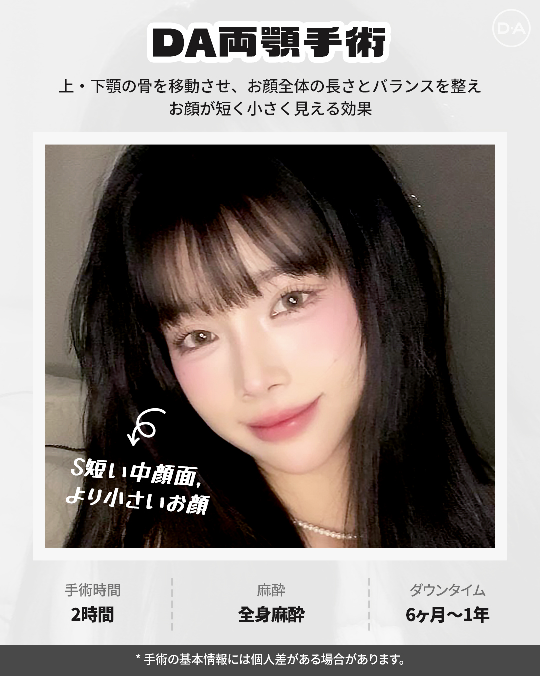 顔の美容外科手術 第2版 | 飯田秀夫 |本 | 通販 | Amazon