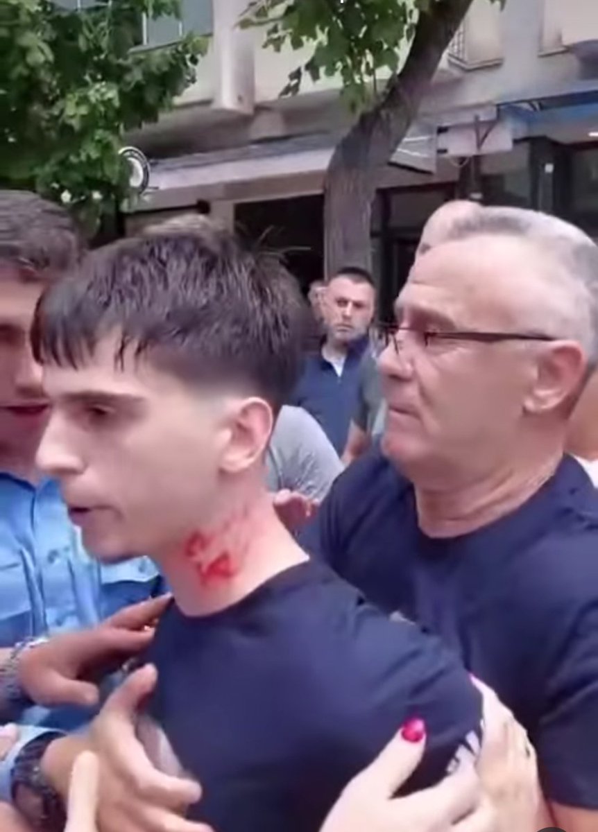 Узрок и последице