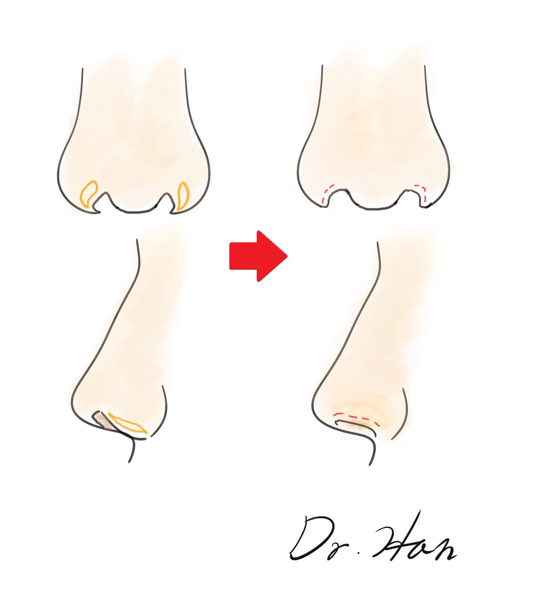 Dr. Han (ハン・サンチョル 院長) tweet media