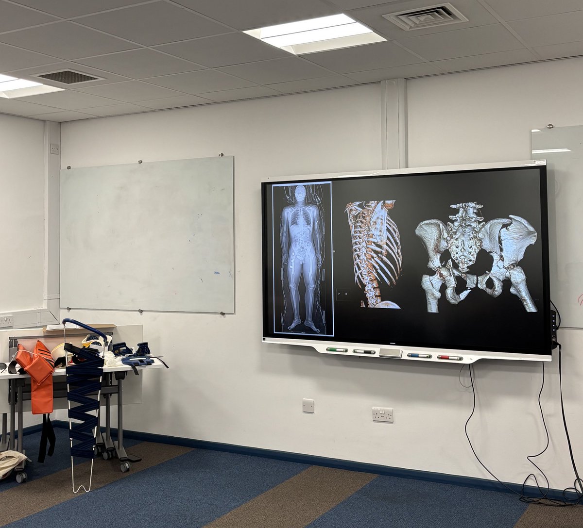 Matt Bellamy (@mattcbellamy) on Twitter photo Sheffield Trauma Day 2025!
Another fantastic course bringing together trauma care, emergency medicine and orthopaedic surgery.
Great workshops, shared learning, and real hands on practice for students!
Thanks to <a href="/sheffieldphem/">sheffphem</a> <a href="/ShefAnCritCare/">SACCS - Sheffield Anaesthetics & Critical Care Soc</a> and all the amazing faculty! Sheffield Trauma Day 2025!
Another fantastic course bringing together trauma care, emergency medicine and orthopaedic surgery.
Great workshops, shared learning, and real hands on practice for students!
Thanks to <a href="/sheffieldphem/">sheffphem</a> <a href="/ShefAnCritCare/">SACCS - Sheffield Anaesthetics & Critical Care Soc</a> and all the amazing faculty!