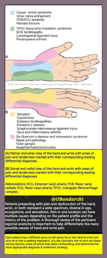 🛑Palmar &amp; ulnar view as well as dorsal &amp; radial view of the hand &amp; wrist with areas of pain &amp; tenderness marked with their corresponding leading differential diagnoses👌

Remember: Each patient has a different story to tell about his/her hand &amp;wrist and why is seeking treatment.
