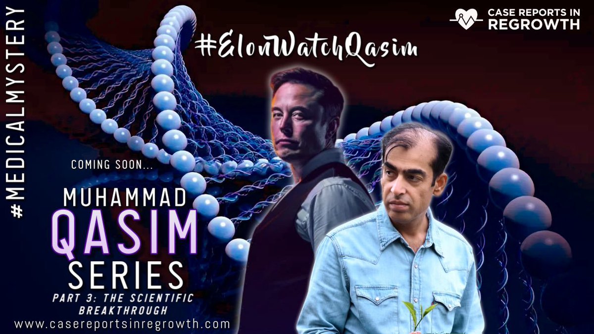 Islamidream's tweet image. Elon This is oh some! This is oh some.

#ElonMusk #Elonwatchqasim
#Elonmuskfans #Elonmustinvestigate