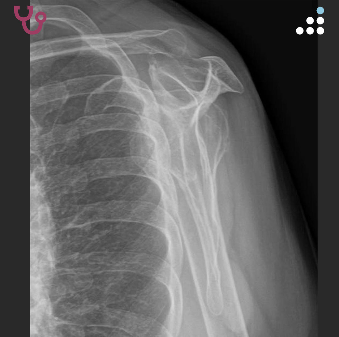 Orthobullets tweet media