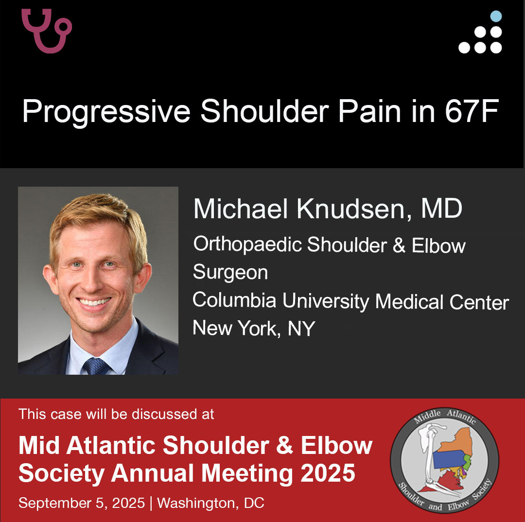 Orthobullets (@orthobullets) on Twitter photo Here is a new case by Dr. Michael Knudsen <a href="/MikeKnudsenMD/">Michael L. Knudsen, MD, FAAOS</a> and Columbia University Medical Center <a href="/OrthoColumbia/">Columbia Orthopedics</a>.
PROGRESSIVE SHOULDER PAIN IN 67F
This case will be debated at the Mid Atlantic Shoulder & Elbow Society Annual Meeting 2025 in Washington, DC, on September 5, 2025. Here is a new case by Dr. Michael Knudsen <a href="/MikeKnudsenMD/">Michael L. Knudsen, MD, FAAOS</a> and Columbia University Medical Center <a href="/OrthoColumbia/">Columbia Orthopedics</a>.
PROGRESSIVE SHOULDER PAIN IN 67F
This case will be debated at the Mid Atlantic Shoulder & Elbow Society Annual Meeting 2025 in Washington, DC, on September 5, 2025.