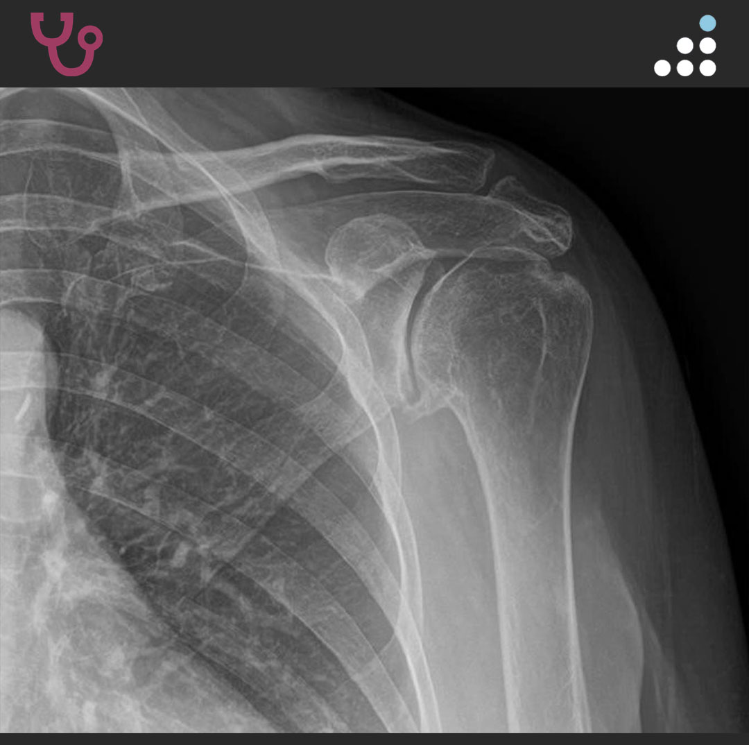 Orthobullets tweet media