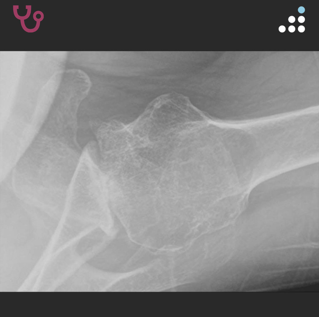 Orthobullets tweet media