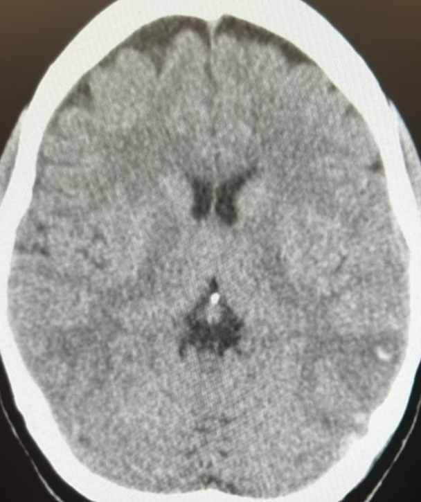 Emergency Medicine Case Challenge:
Seizure and Headache
erpocketbooks.com/ct1/