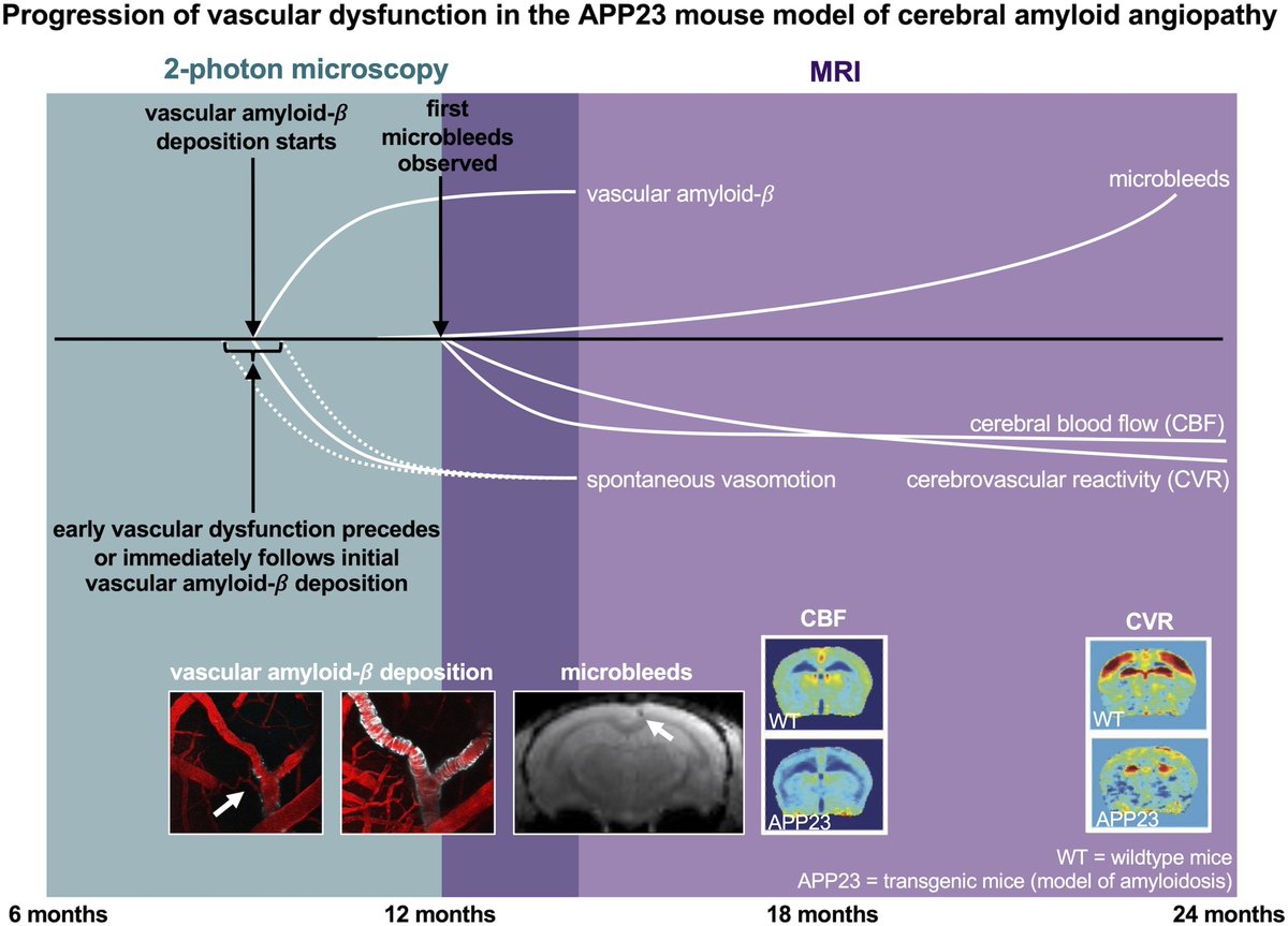 Using multi-modal imaging, Kozberg et al. report that loss of vasomotion occurs early in cerebral amyloid angiopathy in a mouse model. This loss coincided with initial vascular amyloid-β deposition and preceded the occurrence of microbleeds. Read at buff.ly/duW26H0