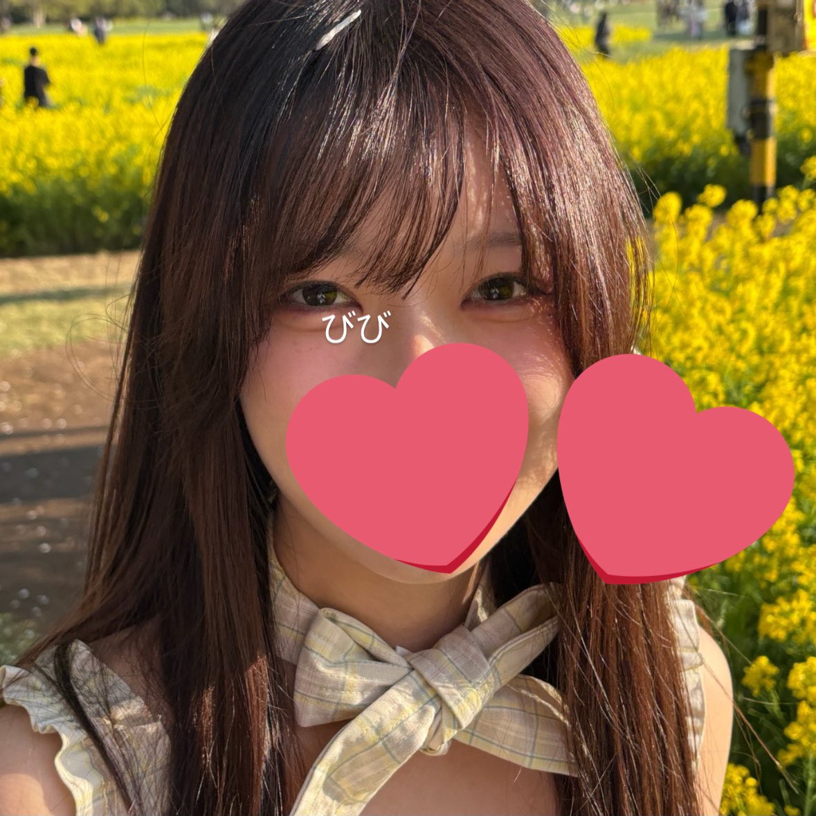 b1b1sk's tweet photo. 【埋没/目頭切開/目尻切開/目下切開 3ヶ月】
zestar美容外科 @zestarps 施術レビュー 3回目

あっという間に3ヶ月が経ちました！ キレイな二重幅で、傷跡もほとんど消えました〜
後戻りは今のところ全く感じません
目頭はまだ赤みが残ってます😢 zestar様にラインで相談しながら様子見てます♪

↓ https://t.co/ZPiL0YJDpg