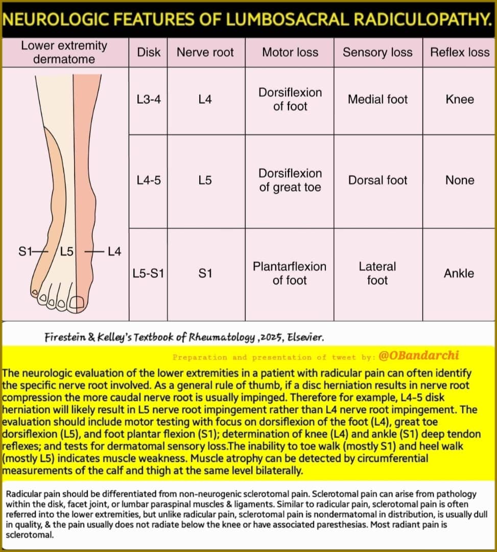 🛑Neurologic features of lumbosacral radiculopathy shown👍

It's worth mentioning that RADICULAR PAIN should be differentiated from NON-NEUROGENIC SCLEROTOMAL PAIN.

Sclerotomal pain can arise from pathology within the disk, facet joint,or lumbar paraspinal muscles &amp; ligaments.