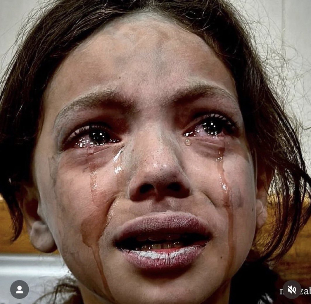 kutubusitte's tweet photo. 🇵🇸#Gazze'de acı cisimleşiyor.. https://t.co/qblbTEKXZw