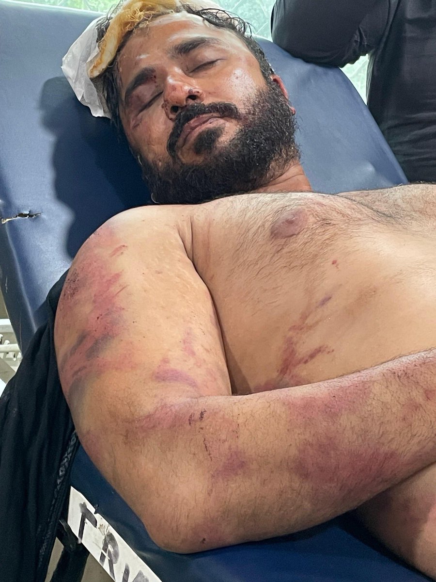 तस्वीरों में दिख रहे लोगों के नाम अकील, अरबाज, कदीम, अकील हैं। ये सभी अलीगढ़ के अतरौली के मीट व्यापारी हैं। ये अल-अम्मार फ्रोज़न फूड्स एक्सपोर्ट प्राइवेट लिमिटेड से पर्ची पर मीट लेकर मैक्स गाड़ी से अतरौली जा रहे थे। रास्ते में पनैठी के पास थाना हरदुआगंज क्षेत्र में हिंदूवादी