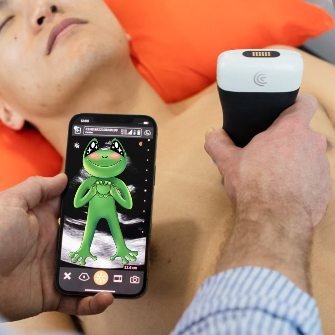 $FROX Forever in our hearts 
CA: CDA8J6HTYGCzhB6VYGAw6tvDYbpsy9FMt2D7w4UmtuVi