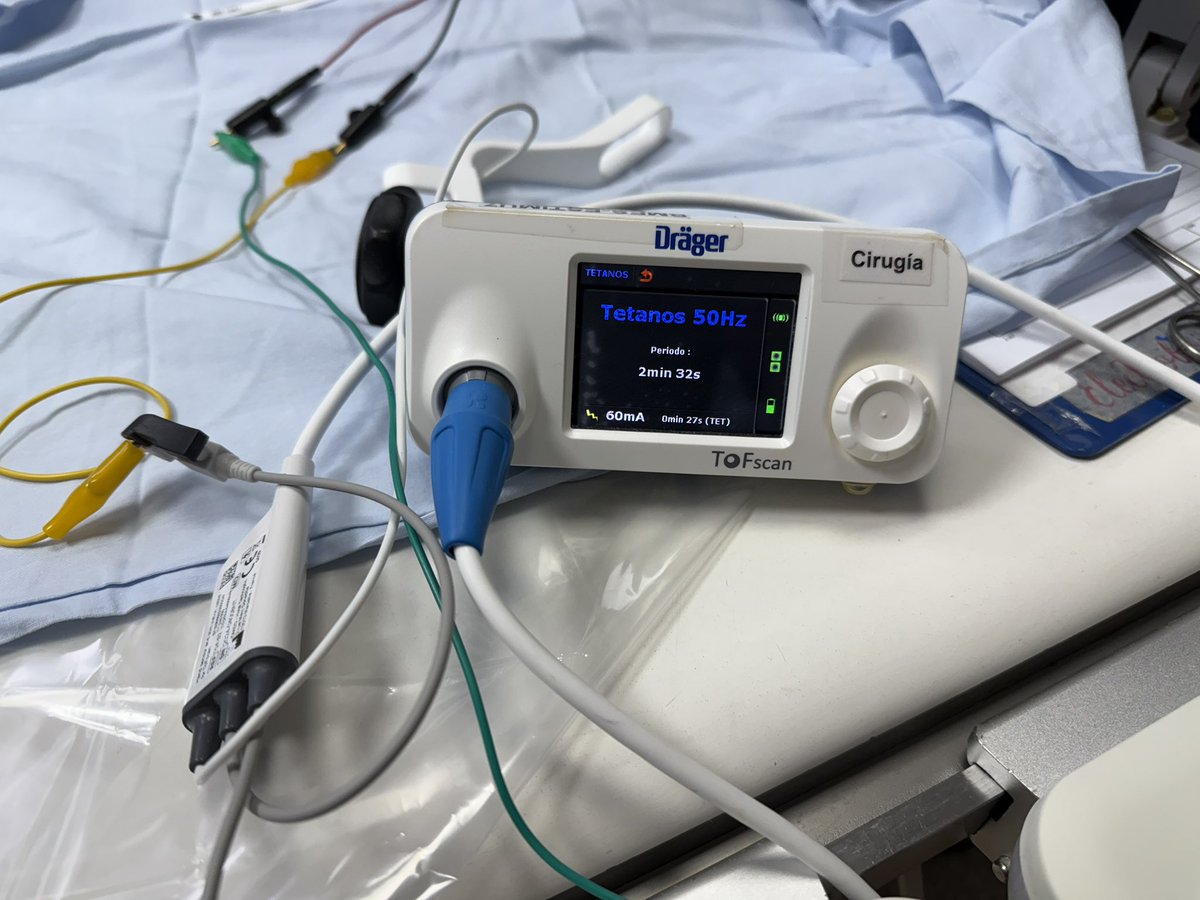 Sri Sundaram (@srissundaram) on Twitter photo <a href="/martinjuan75/">martinjuan75</a> <a href="/VanPittar/">Vanessa Pittar | EP ABBOTT</a> <a href="/CardioVid/">Clínica Cardio VID</a> <a href="/AbbottCardio/">Abbott Cardiovascular</a> Had the pleasure of doing a CNA ablation with Dr Juan Uribe at CardioVid Hospital Medellin, Colombia last week. Exchanged ideas and learned about his extravagant stimulator. <a href="/martinjuan75/">martinjuan75</a> <a href="/VanPittar/">Vanessa Pittar | EP ABBOTT</a> <a href="/CardioVid/">Clínica Cardio VID</a> <a href="/AbbottCardio/">Abbott Cardiovascular</a> Had the pleasure of doing a CNA ablation with Dr Juan Uribe at CardioVid Hospital Medellin, Colombia last week. Exchanged ideas and learned about his extravagant stimulator.
