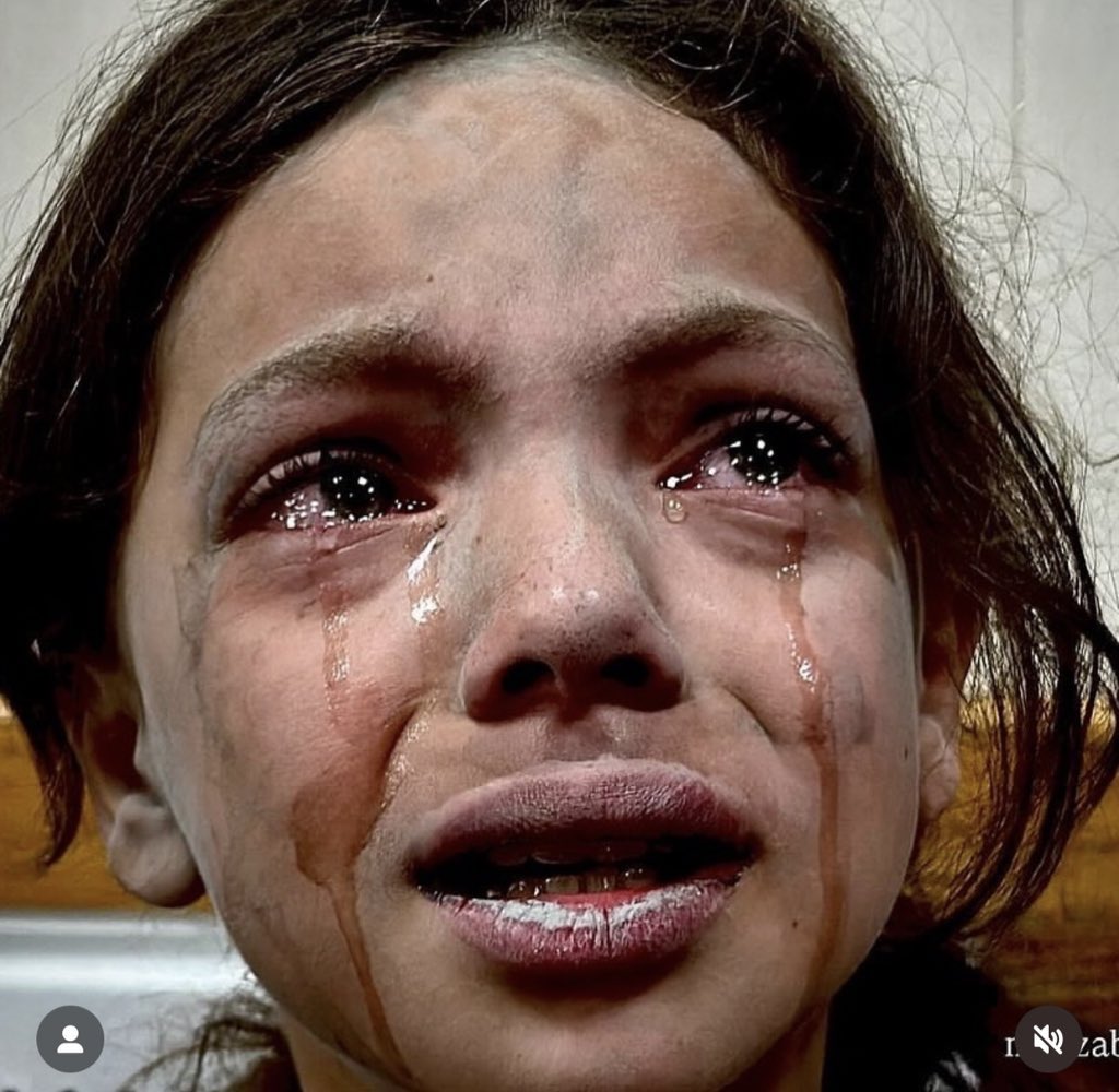 NoWords 
If you see this pic, reply with 🍉🇵🇸 and spread it💔