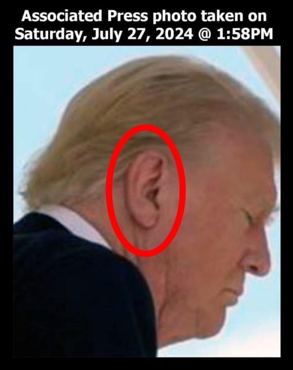 Dr. Gichuho Mungai, Ed.D., MBA, M.Sc., PGD, B.ED. (@gichuhomungai) on Twitter photo <a href="/mmpadellan/">BrooklynDad_Defiant!☮️</a> Trump's intact ear less than 48 hrs after being "shot" by a high-powered bullet.
He never even suffered "auditory exclusion" which is temporary deafness from intense pain, medically expected in such events! <a href="/mmpadellan/">BrooklynDad_Defiant!☮️</a> Trump's intact ear less than 48 hrs after being "shot" by a high-powered bullet.
He never even suffered "auditory exclusion" which is temporary deafness from intense pain, medically expected in such events!