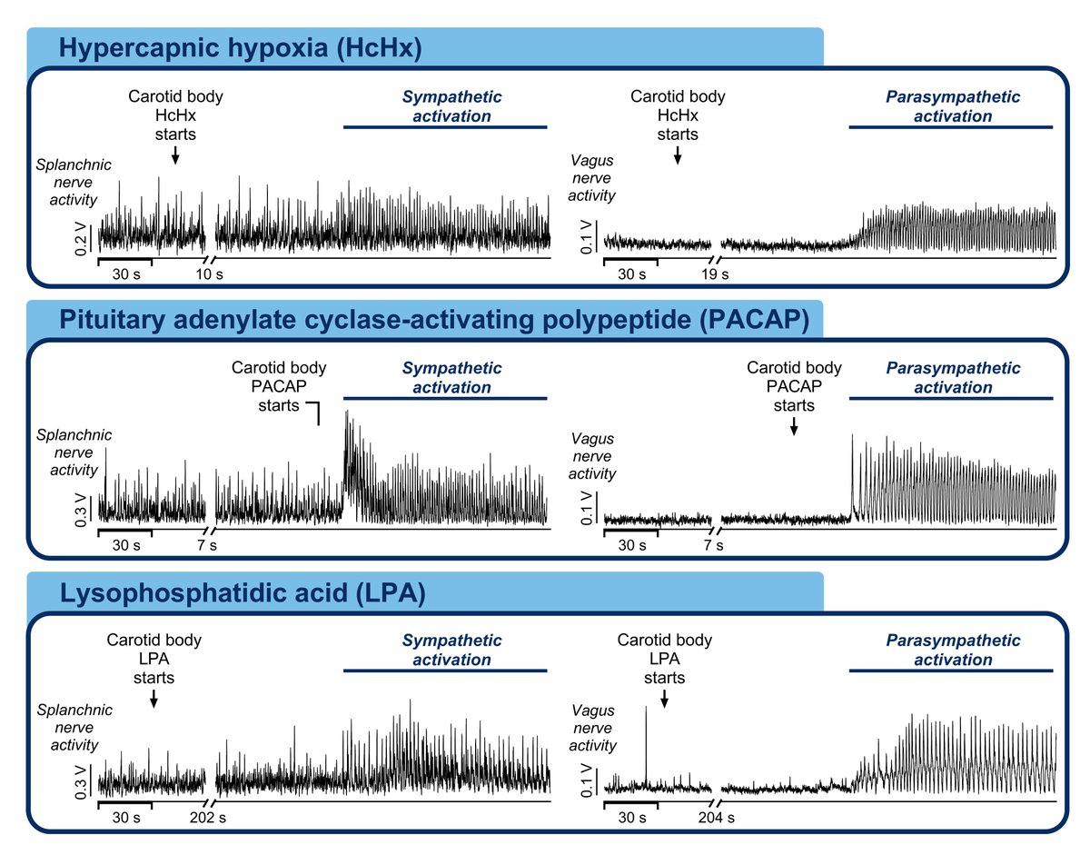 Circulation Research (@circres) on Twitter photo <a href="/CircRes/">Circulation Research</a> Compendium on Interorgan Crosstalk in #HeartFailure and #Cardiometabolic Diseases
@avincognito et al Research Letter "#Carotid Body Stress & #Inflammatory Mediators Uniformly Excite Autonomic Output" ahajrnls.org/43egUlx <a href="/CircRes/">Circulation Research</a> Compendium on Interorgan Crosstalk in #HeartFailure and #Cardiometabolic Diseases
@avincognito et al Research Letter "#Carotid Body Stress & #Inflammatory Mediators Uniformly Excite Autonomic Output" ahajrnls.org/43egUlx