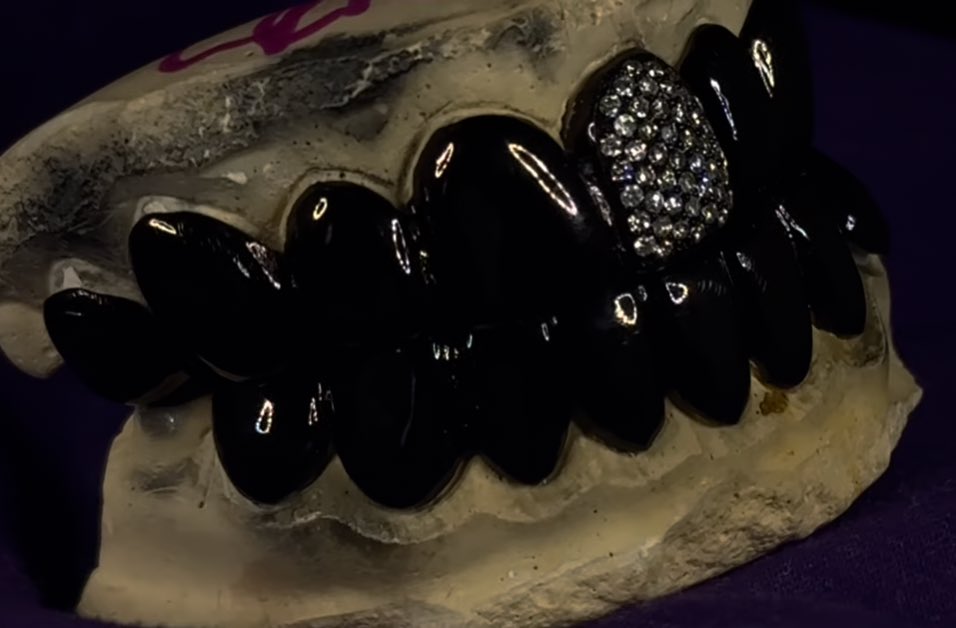 Black Grillz by Zero Below