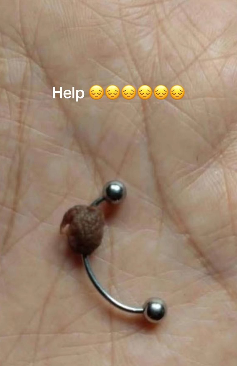 GirthyPickle's tweet photo. Mf got mad and bit it off 🙄 https://t.co/Qix0OIiigP