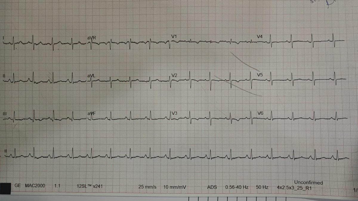 Young morbid obese female.. SOB since 10 days..