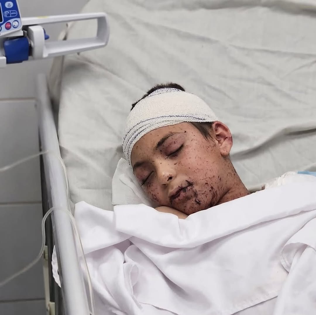 EyeonPalestine's tweet photo. The first two photos are of Dr. al-Najjar’s only surviving child, Adam (11), and the third photo is of her husband, Dr. Hamdi al-Najjar, who also remains in critical condition. https://t.co/qvZguMpohA