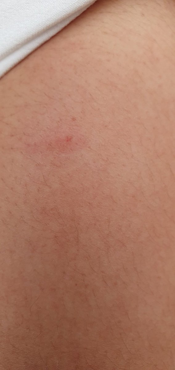 Cuidado!!  Esta tarde íbamos en el metro Línea 2 se San Antonio Abad a Ermita y pues nada piquete de esos que están de moda.. 

Mucho cuidado quien tienen a lado....

#cdmx <a href="/SSC_CDMX/">SSC CDMX</a> <a href="/MetroCDMX/">MetroCDMX</a>   <a href="/GobCDMX/">Gobierno de la Ciudad de México</a>