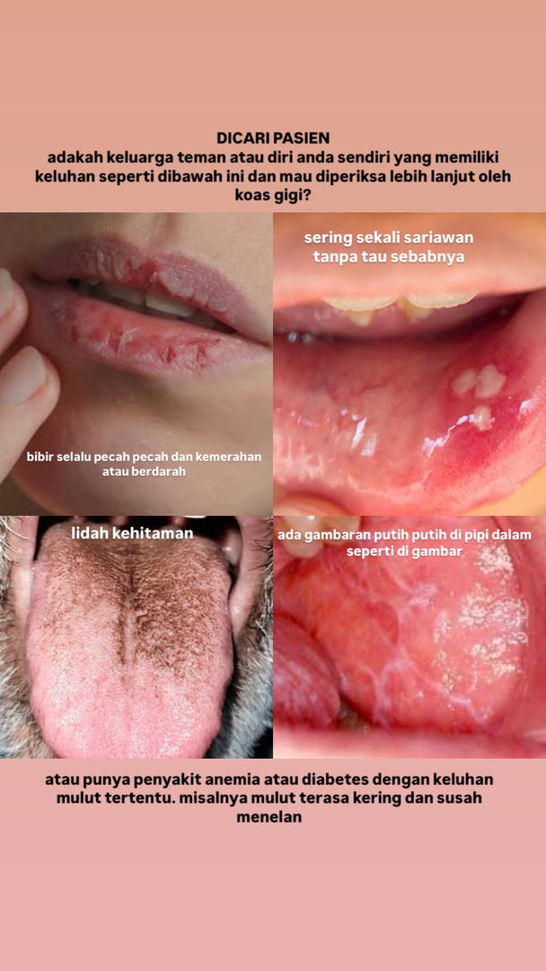 JOGJA FESS | KIRIM FESS CEK PINNED tweet media