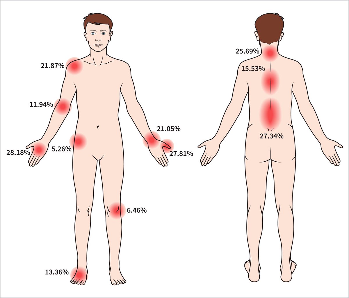 Sites of endoscopy related injury in endoscopists, based on the most comprehensive meta-analysis to date 📍

📸: <a href="/UEGJournal/">UEGJ</a> 
onlinelibrary.wiley.com/doi/10.1002/ue…