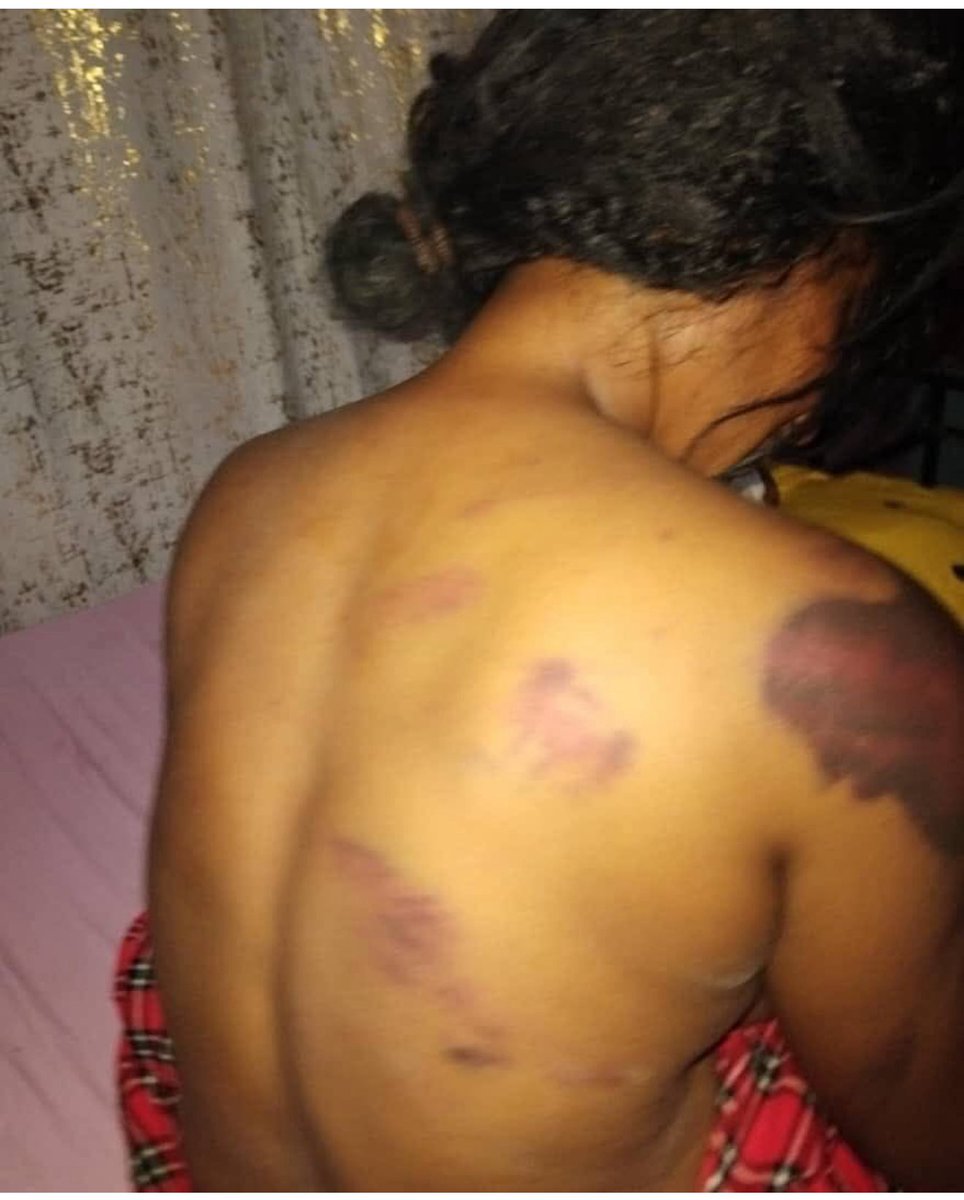 Huyu ni Pendo maelezo yake yanafanana na alichokisema Agather kuhusu kuteswa kudhalilishwa na kuvuliwa nguo..

Bahati mbaya sijasikia feminist wakisema chochote kuhusu matendo haya ya kinyama waliyofanyiwa wanawake.

Rais ambae ni mama hajasema chochote kuhusu unyama huu, Kama