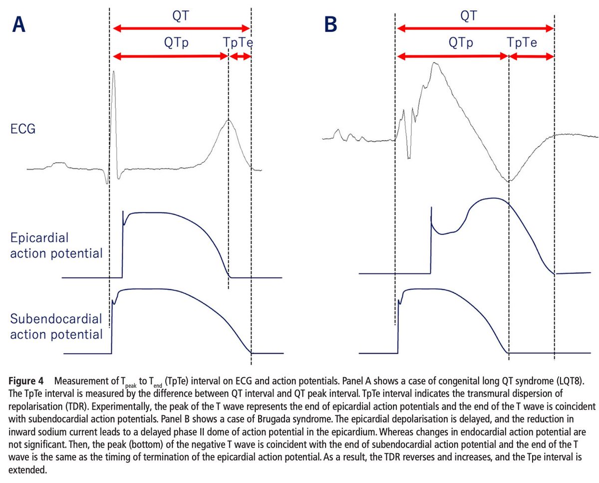 SeguraCardio's tweet photo. 📌#StateOTheArt analysis of #ECG findings in sudden cardiac death⚡️

#SCD #epeeps #LQTS #Brugada #ACS #MitralValveProlapse #ARVC https://t.co/wBRDH1fC87