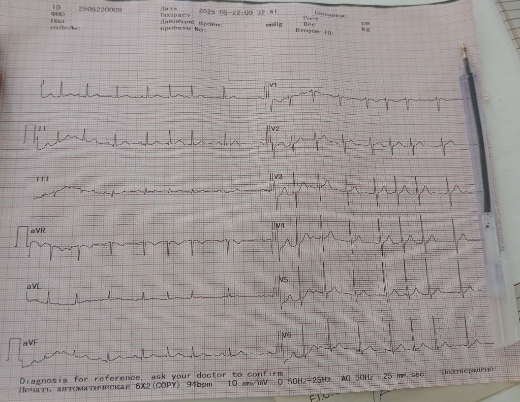 Asymptomatic patient, dx?
