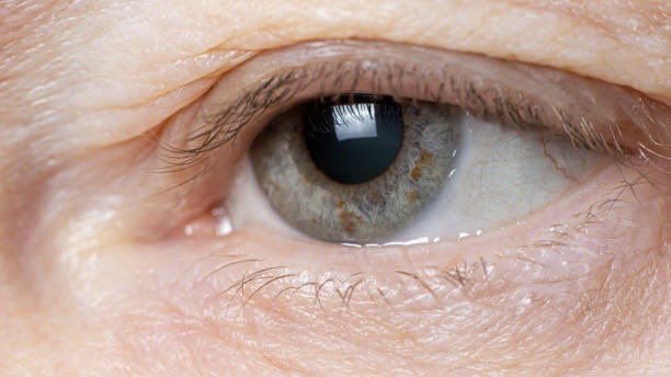 “Ocular ptosis, or drooping of the upper eyelid, can be caused by various factors and requires careful differential diagnosis” (NIH)

Ask Noah AI: What are the key differential diagnoses for ocular ptosis? noahai.co/ask