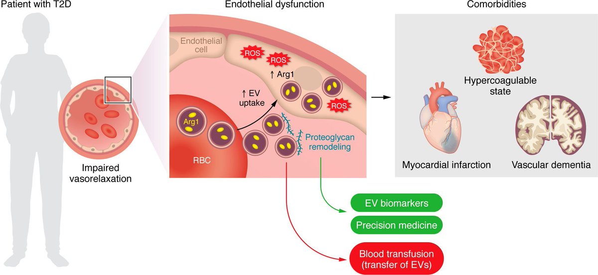 Journal of Clinical Investigation (@jclinicalinvest) on Twitter photo ICYMI: Endothelial dysfunction in patients with type 2 diabetes: The truth is in the blood: jci.org/articles/view/…
Sarah Costantino, Shafeeq A. Mohammed, & <a href="/FrancescoPaneni/">Francesco Paneni</a> provide a Commentary on Collado et al. (jci.org/articles/view/…) ICYMI: Endothelial dysfunction in patients with type 2 diabetes: The truth is in the blood: jci.org/articles/view/…
Sarah Costantino, Shafeeq A. Mohammed, & <a href="/FrancescoPaneni/">Francesco Paneni</a> provide a Commentary on Collado et al. (jci.org/articles/view/…)