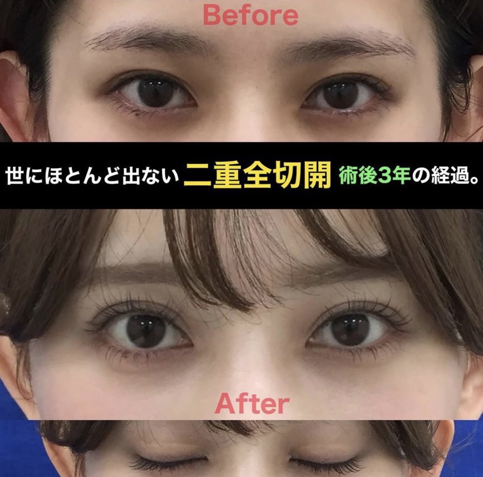 nya___32's tweet photo. めっちゃ綺麗 https://t.co/OLvSOG125Y