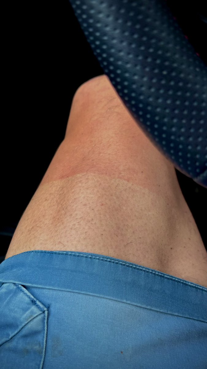 Reci da si biciklorao za vikend da ne kažeš da si biciklirao za vikend