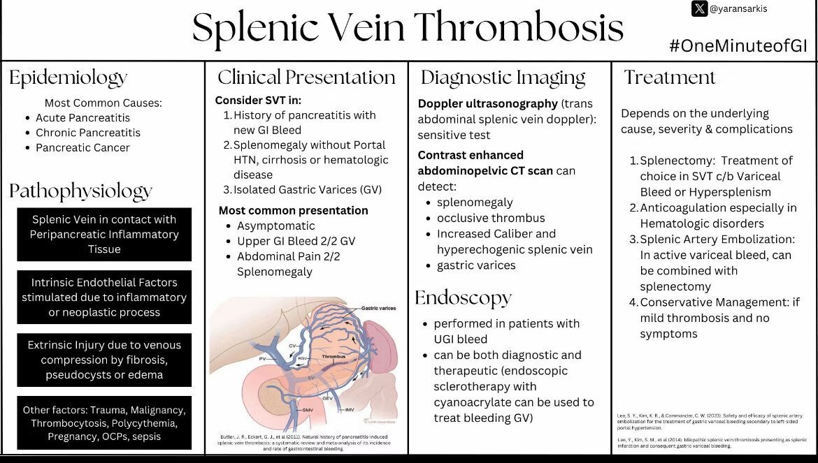Splenic Vein Thrombosis

By Dr. Yana Sarkis