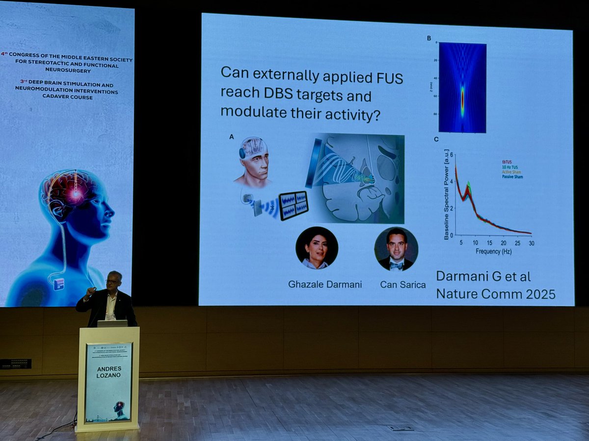 CANSARICA2's tweet image. Happy to share our work at the 4th Congress of Middle Eastern Society for Stereotactic and Functional Neurosurgery (#MSSFN) in my beautiful hometown, Istanbul—presenting with Dr. Lozano and Dr. Hodaie @mhodaie as the #TorontoWestern team.