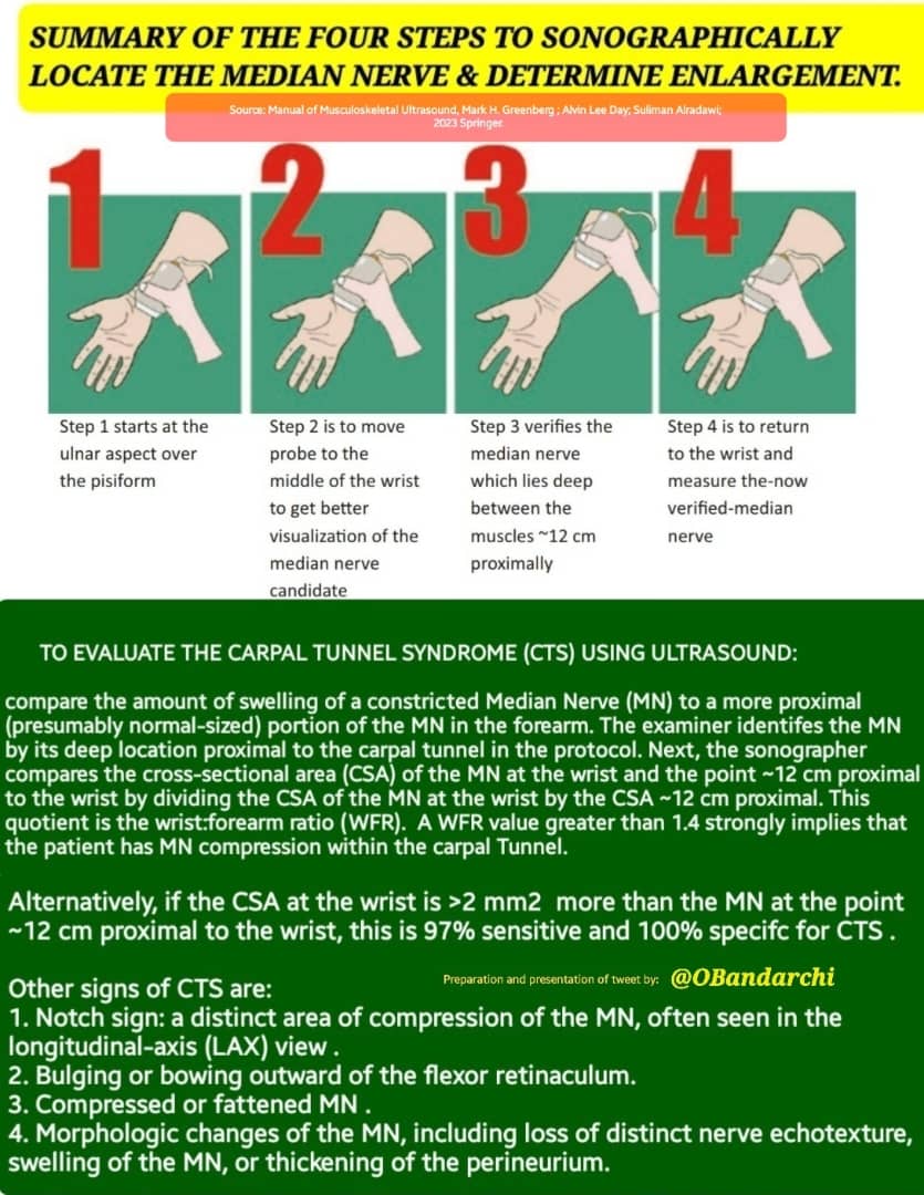 🛑Ultrasound evaluation of the carpal tunnel syndrome (CTS) made easy 👍 Just performing the 4 steps....