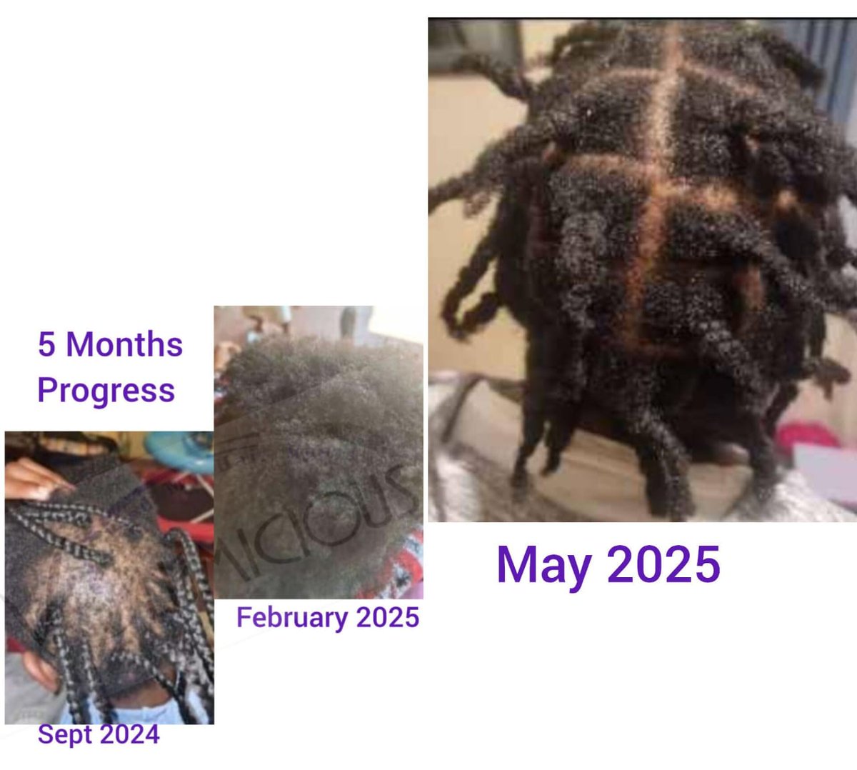 REAL PEOPLE, REAL RESULTS

The PATCH IS PERMANENTLY CLOSED

VOLUMICIOUS WORm'l'

Start your Hair journey today

volumicious.co.za 

#TransformwithVOLUMICIOUS