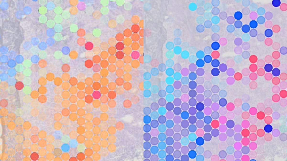 Barts Cancer Institute (Queen Mary) (@qmbci) on Twitter photo 📰A new study by BCI <a href="/QMUL/">Queen Mary University of London</a> has uncovered molecules that enable bowel cancer cells to hijack our gut’s natural healing processes to adapt, spread and grow.
Read more: bci.qmul.ac.uk/general-news/2…
<a href="/QMULBartsTheLon/">Barts and The London, Queen Mary</a> | <a href="/CRUKCOLcentre/">CRUKCOLcentre</a> 📰A new study by BCI <a href="/QMUL/">Queen Mary University of London</a> has uncovered molecules that enable bowel cancer cells to hijack our gut’s natural healing processes to adapt, spread and grow.
Read more: bci.qmul.ac.uk/general-news/2…
<a href="/QMULBartsTheLon/">Barts and The London, Queen Mary</a> | <a href="/CRUKCOLcentre/">CRUKCOLcentre</a>