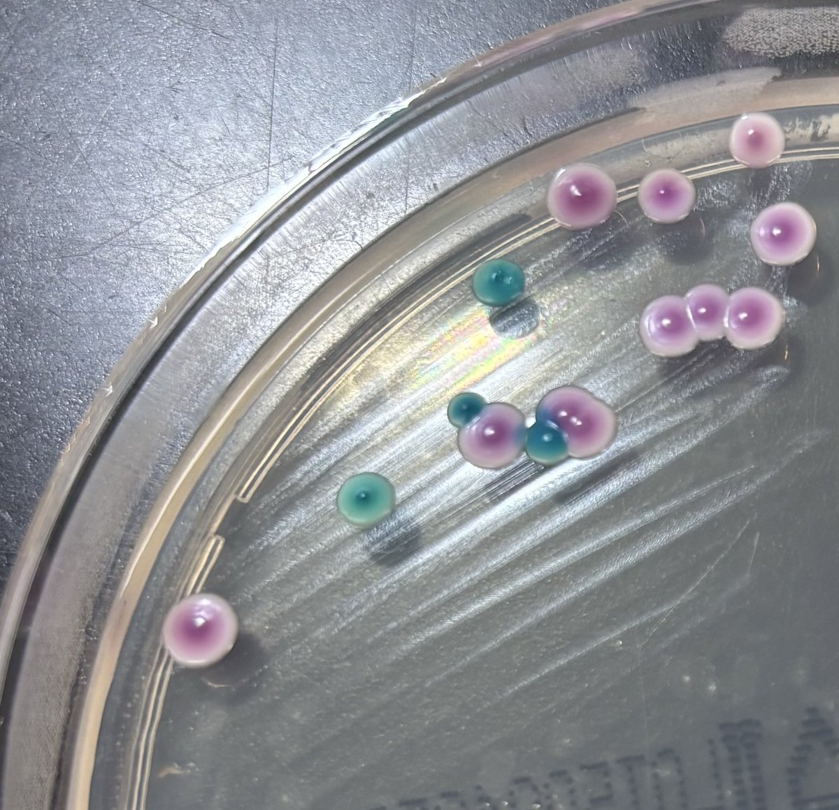 candyca88328815's tweet photo. C. albicans と C. dubliniensis
形態学的･生化学的性状では鑑別困難。CHROM CANDIDAⅡ培地でalbicansは緑,dubliniensisは深緑。CANDIDA PLUS培地でalbicansはハロー+。どちらも発芽管形成試験+で厚膜胞子+だが,dubliniensisは菌糸先端に複数の厚膜胞子を形成し42℃でも発育する。MALDIで同定可能。 https://t.co/hZKJVBu1Og