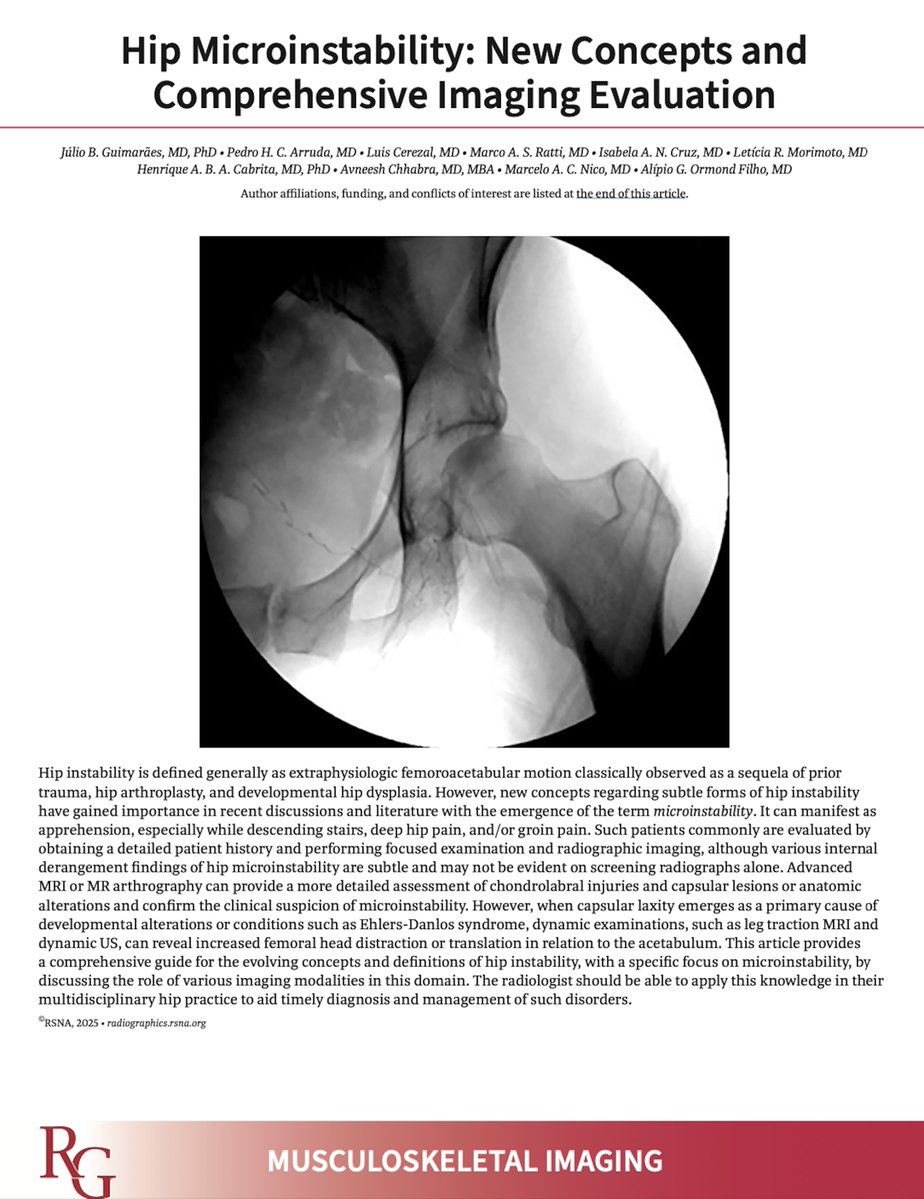 Julio B. Guimaraes, MD, PhD (@juliobguimaraes) on Twitter photo Our manuscript about hip microinstability was just published at
<a href="/RadioGraphics/">RadioGraphics</a> !!! New Concepts and Comprehensive imaging evaluation!!! Many thanks for the great work
<a href="/DmcRadiologia/">Luis Cerezal</a> and <a href="/AChhabraMD/">Avneesh Chhabra, MD, MBA, FACR</a>
pubs.rsna.org/doi/epdf/10.11… Our manuscript about hip microinstability was just published at
<a href="/RadioGraphics/">RadioGraphics</a> !!! New Concepts and Comprehensive imaging evaluation!!! Many thanks for the great work
<a href="/DmcRadiologia/">Luis Cerezal</a> and <a href="/AChhabraMD/">Avneesh Chhabra, MD, MBA, FACR</a>
pubs.rsna.org/doi/epdf/10.11…