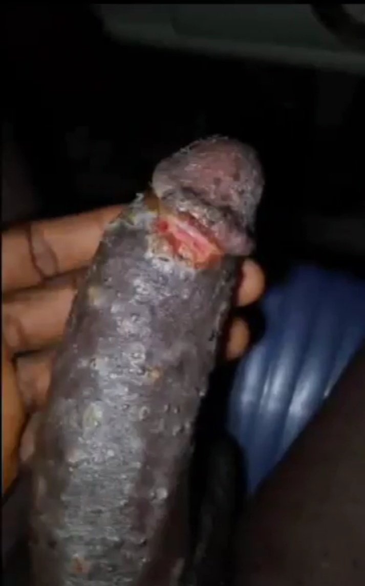 GYerathel's tweet photo. Normalize using condoms your girlfriends are sleeping with sick people for money!!! https://t.co/42Xuz4YoVn