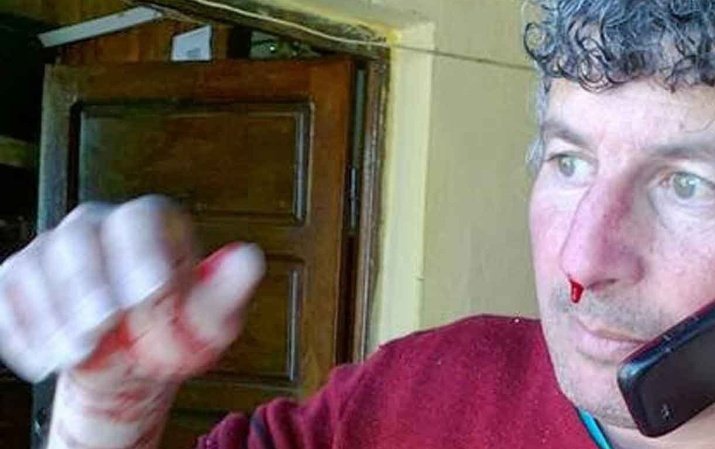 FurmanElias's tweet image. Como de costumbre cada día del periodista los gobernantes de localidades entrerrianas le hacen obsequios y hasta homenajes a sus periodistas alcahuetes. 
A mi ni nada!
Ni saludan ,menos aún obsequios, nada .
Es el costo de ser honesto y denunciar las corrupciones.