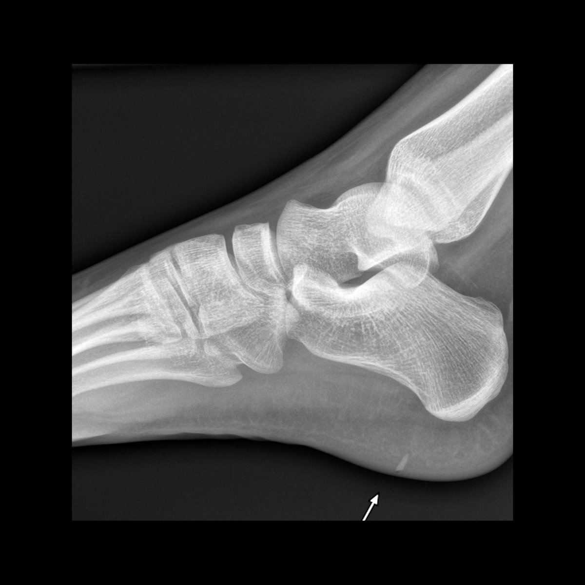 Pediatric Imaging tweet media