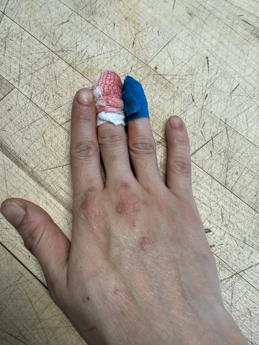 Akhirnya setelah sekian waktu, dikasih juga kesempatan hampir ilang jari wkwkwkw