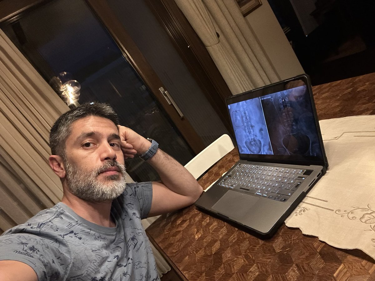 T. Emre Sener (@dremresener) on Twitter photo Getting ready for the ESU <a href="/UrowebESU/">European School of Urology (EAU ESU)</a> course during LXXXVIII Congreso Nacional de Urología in Cádiz. Getting ready for the ESU <a href="/UrowebESU/">European School of Urology (EAU ESU)</a> course during LXXXVIII Congreso Nacional de Urología in Cádiz.
