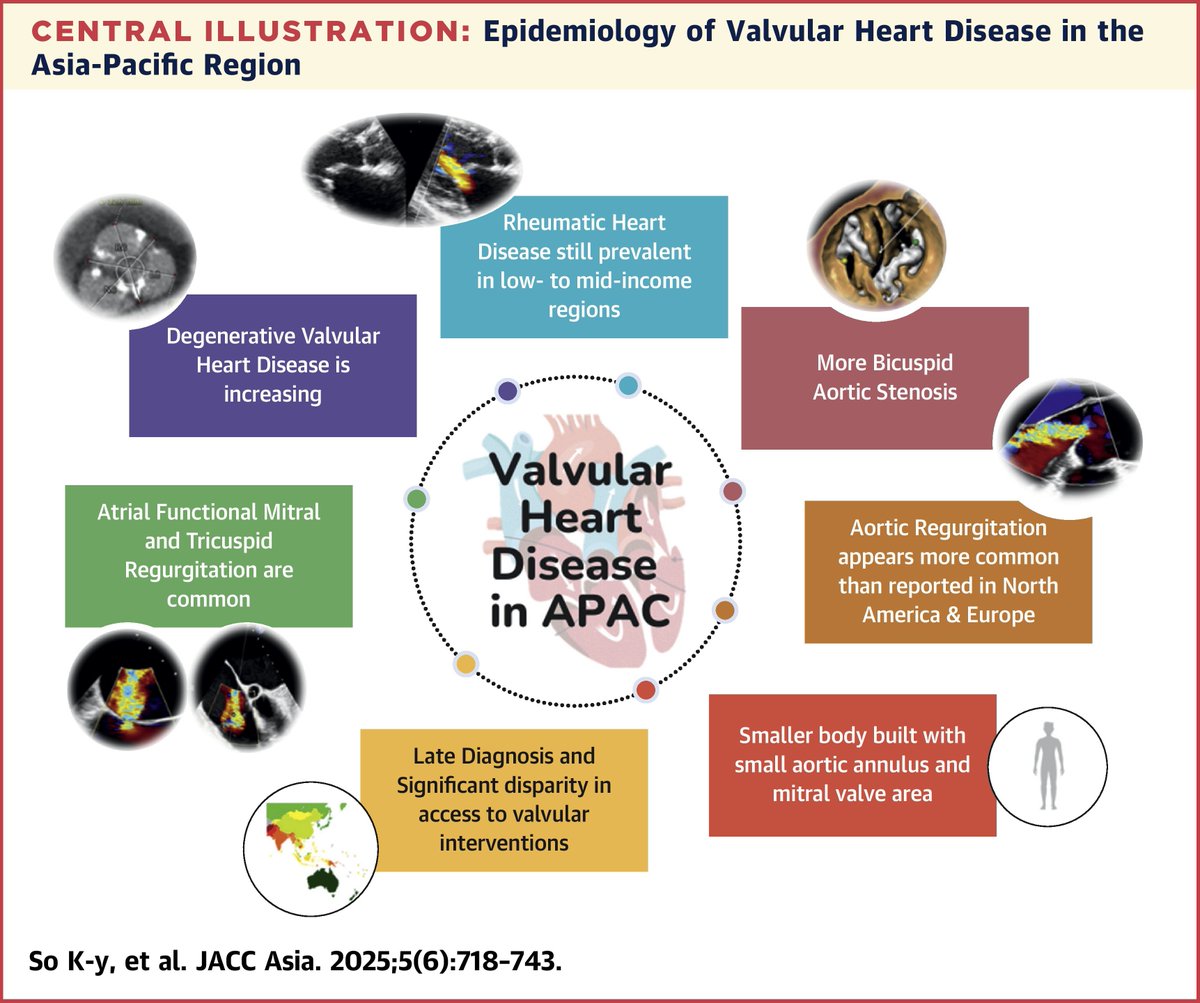 JACC Journals (@jaccjournals) on Twitter photo #cvVHD burdens the Asia-Pacific, w/ rheumatic forms in LMICs & degenerative disease 📈 in aging populations. Access to care remains uneven. Transcatheter solutions are growing—regional collaboration is 🔑 to addressing this surge 🤝 jacc.org/doi/10.1016/j.… #JACCAsia <a href="/kentso987/">Kent, So</a> #cvVHD burdens the Asia-Pacific, w/ rheumatic forms in LMICs & degenerative disease 📈 in aging populations. Access to care remains uneven. Transcatheter solutions are growing—regional collaboration is 🔑 to addressing this surge 🤝 jacc.org/doi/10.1016/j.… #JACCAsia <a href="/kentso987/">Kent, So</a>