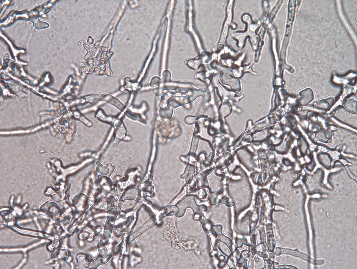 Christ Mane BELIZAIRE (@chrissiebely) on Twitter photo Had the chance to perform diagnostic on young blueberry plants looked drought-stressed: chlorosis, wilting, dieback. But microscopy after 2 days revealed coenocytic hyphae, coralloid mycelium, and swellings. Classic features of #Phytophthora root rot.
<a href="/UFPlantPath/">UF/IFAS Plant Pathology Department</a> <a href="/ClinicPlant/">Tropical Plant Clinic & Research Lab</a> Had the chance to perform diagnostic on young blueberry plants looked drought-stressed: chlorosis, wilting, dieback. But microscopy after 2 days revealed coenocytic hyphae, coralloid mycelium, and swellings. Classic features of #Phytophthora root rot.
<a href="/UFPlantPath/">UF/IFAS Plant Pathology Department</a> <a href="/ClinicPlant/">Tropical Plant Clinic & Research Lab</a>
